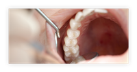 Durch eine professionelle Vorsorge bei Zahnarzt Dr. med. dent. Armin Eisermann in Blaustein lassen sich viele Krankheiten an Ihren Zähnen verhindern.